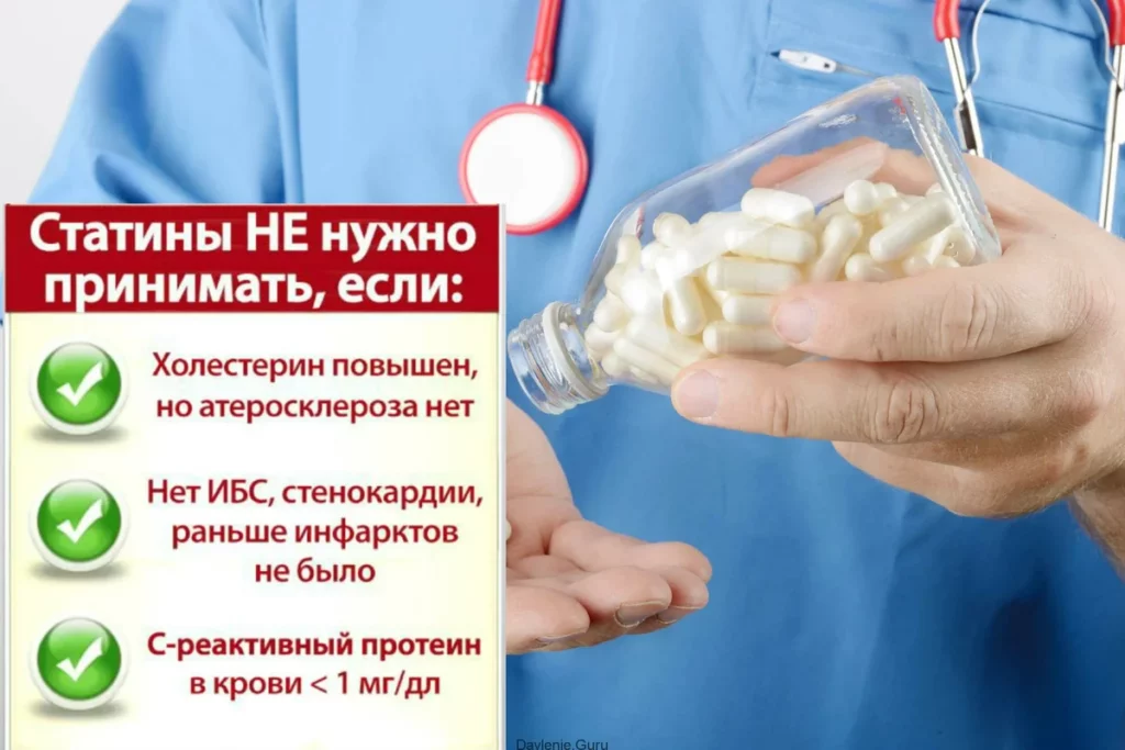Статины