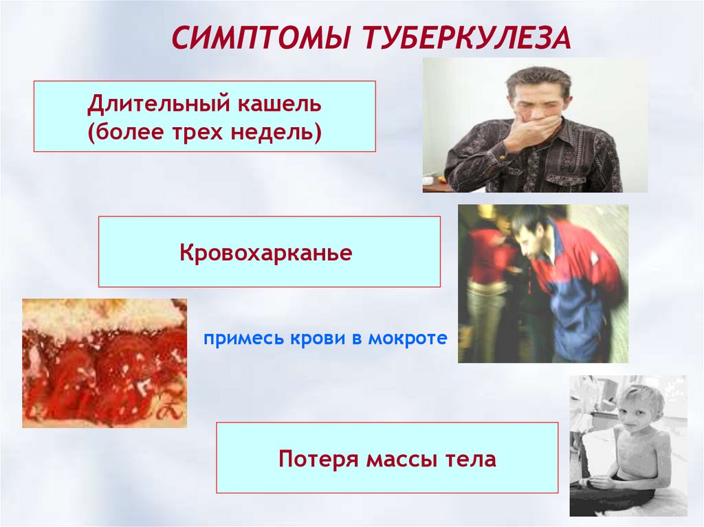 Симптомы туберкулеза