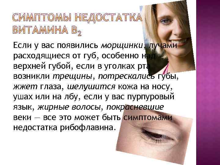 Заеды уголков рта