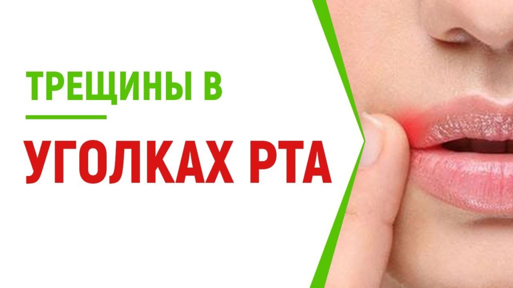 Заеды 