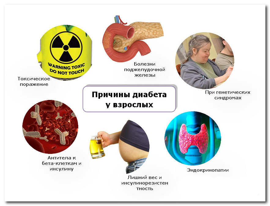 Причины диабета у взрослых